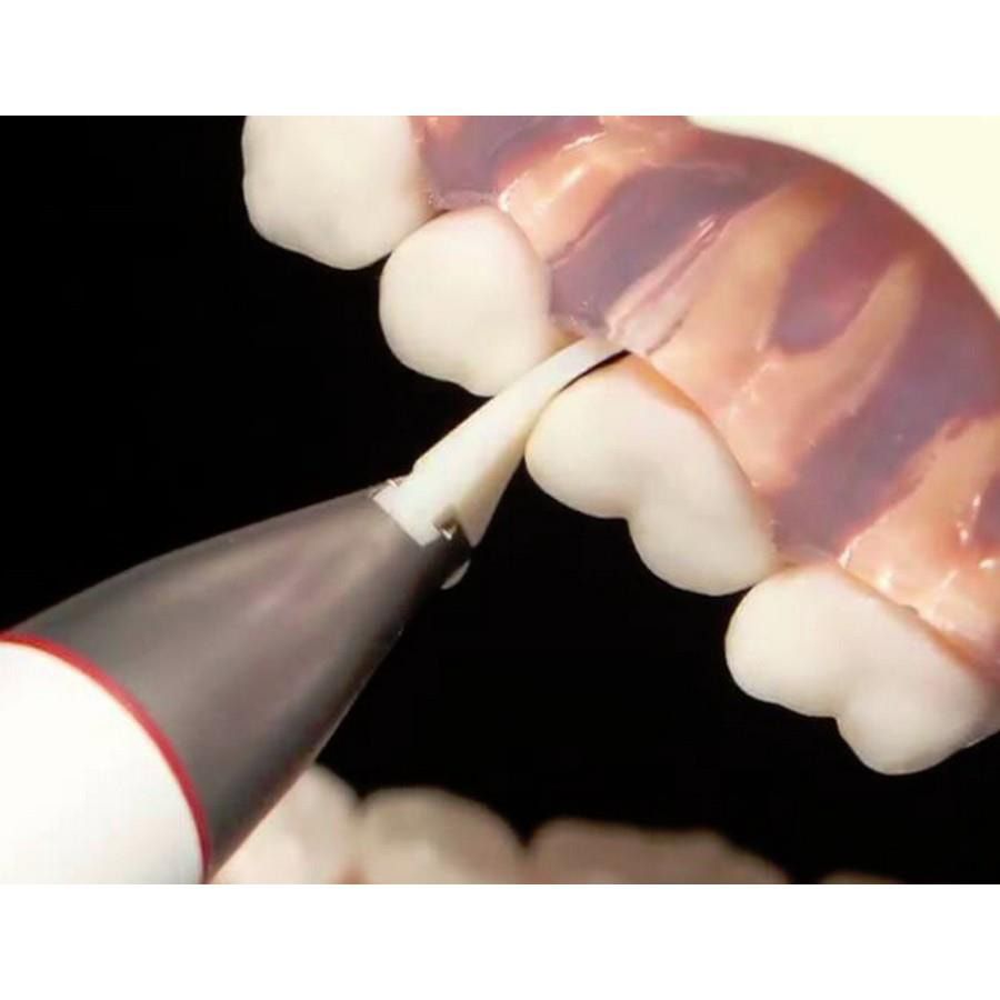 EMS PerioFlow Nozzles (40)